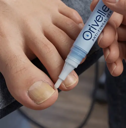 Orivelle Fungus Pen reviews 